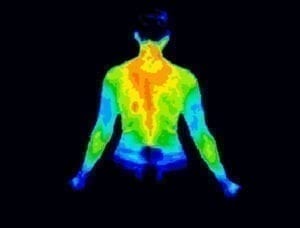 Human body emitting non- trivial amounts of ionizing radiation. 